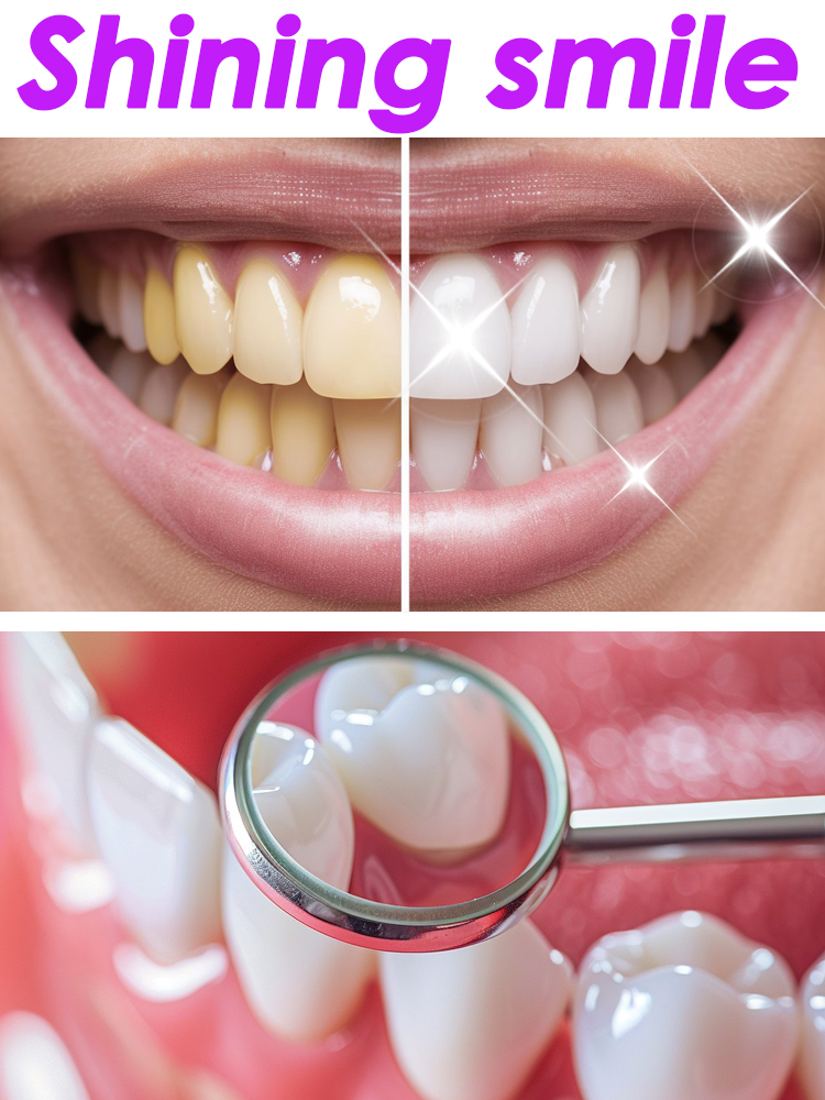 Teeth Whitening Xylitol - GlorySmile تبييض الأسنان معجون الأسنان الفواكه