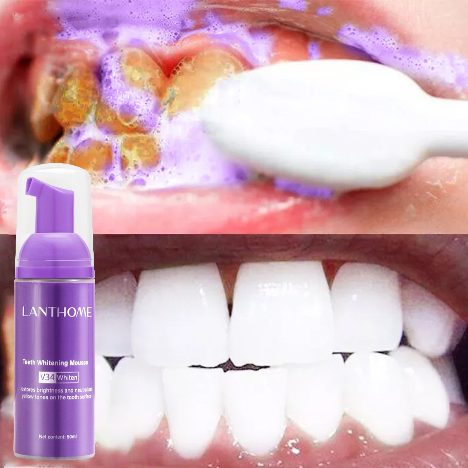 Teeth Whitening Xylitol - V34 معجون أسنان موس لتبييض الأسنان