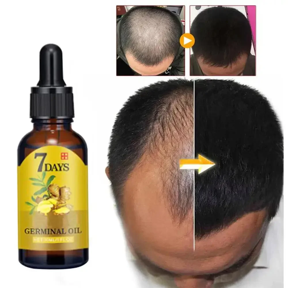 Coconut Oil Pull - نمو الشعر الزنجبيل سريع النمو زيت