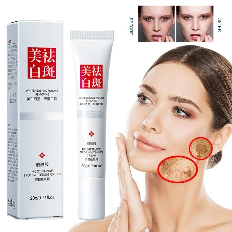 تتلاشى وتحسين النمش البقع السو - مراجعة Charcoal Whitening Paste وسعره