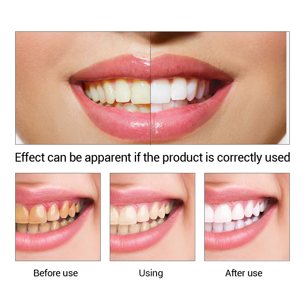 Fteenly تبييض الأسنان جوهر مسح - مراجعة Teeth Whitening Essence وسعره