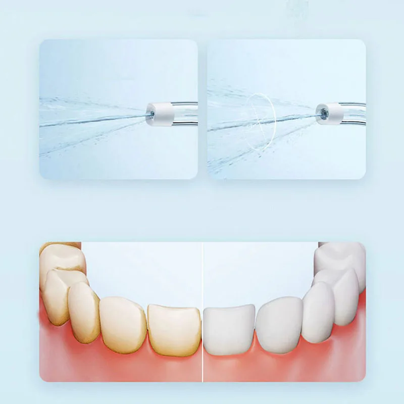 جهاز شاومي المحمول لتنظيف الأس - مراجعة Teeth Whitening Quick وسعره