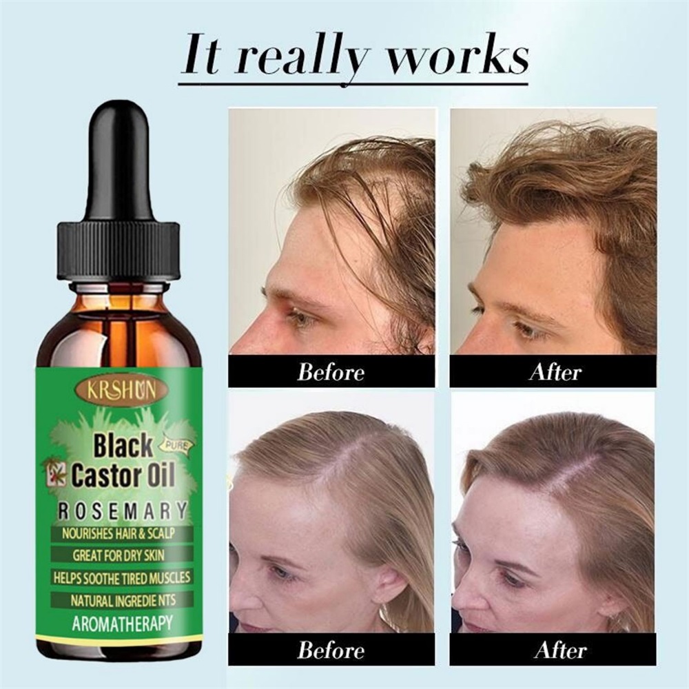 زيت الخروع الأسود يغذي نمو الش - مراجعة Coconut Oil Pull وسعره