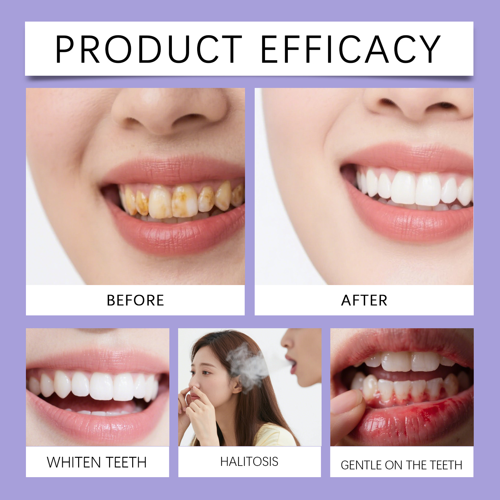 غسول فم بنكهة النعناع الطبيعية - مراجعة Teeth Whitening Xylitol وسعره