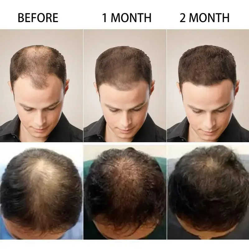 نمو الشعر الزنجبيل سريع النمو  - مراجعة Coconut Oil Pull وسعره
