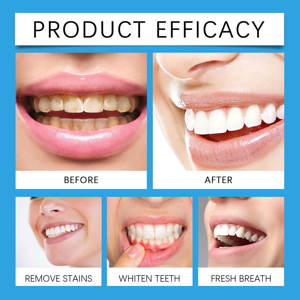 مسحوق احترافي لإزالة بقع الأسن - مراجعة Teeth Whitening For Photos وسعره